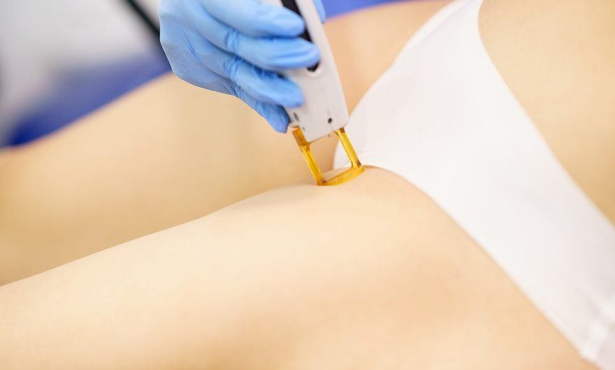 Bikini Laser Hair Removal: What to Know Before Your Appointment