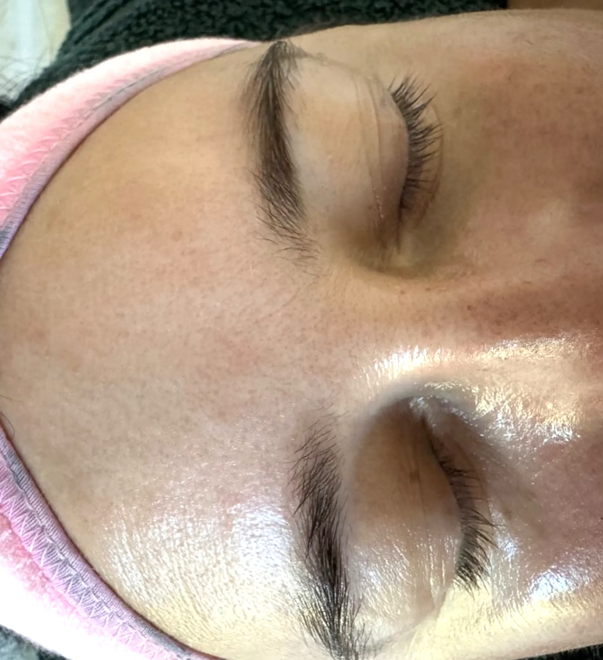 UV exposure vs vitamin D