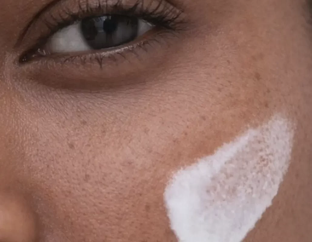 What Is Dry Skin Lacking In?