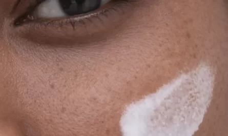 What Is Dry Skin Lacking In?