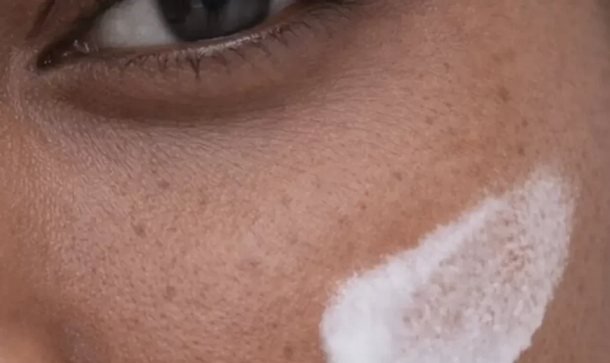 What Is Dry Skin Lacking In?