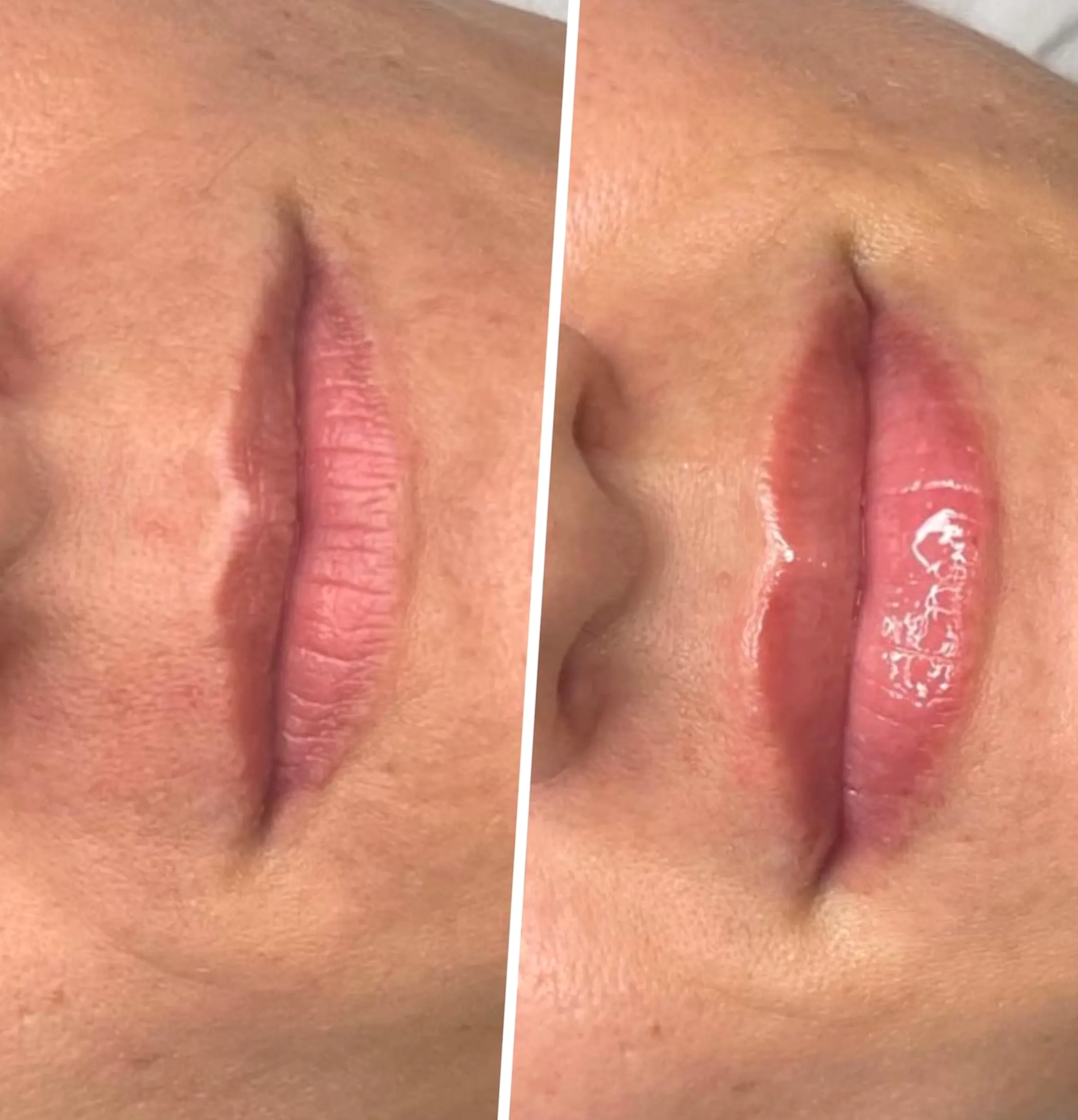 vitamin D and skin pigmentation