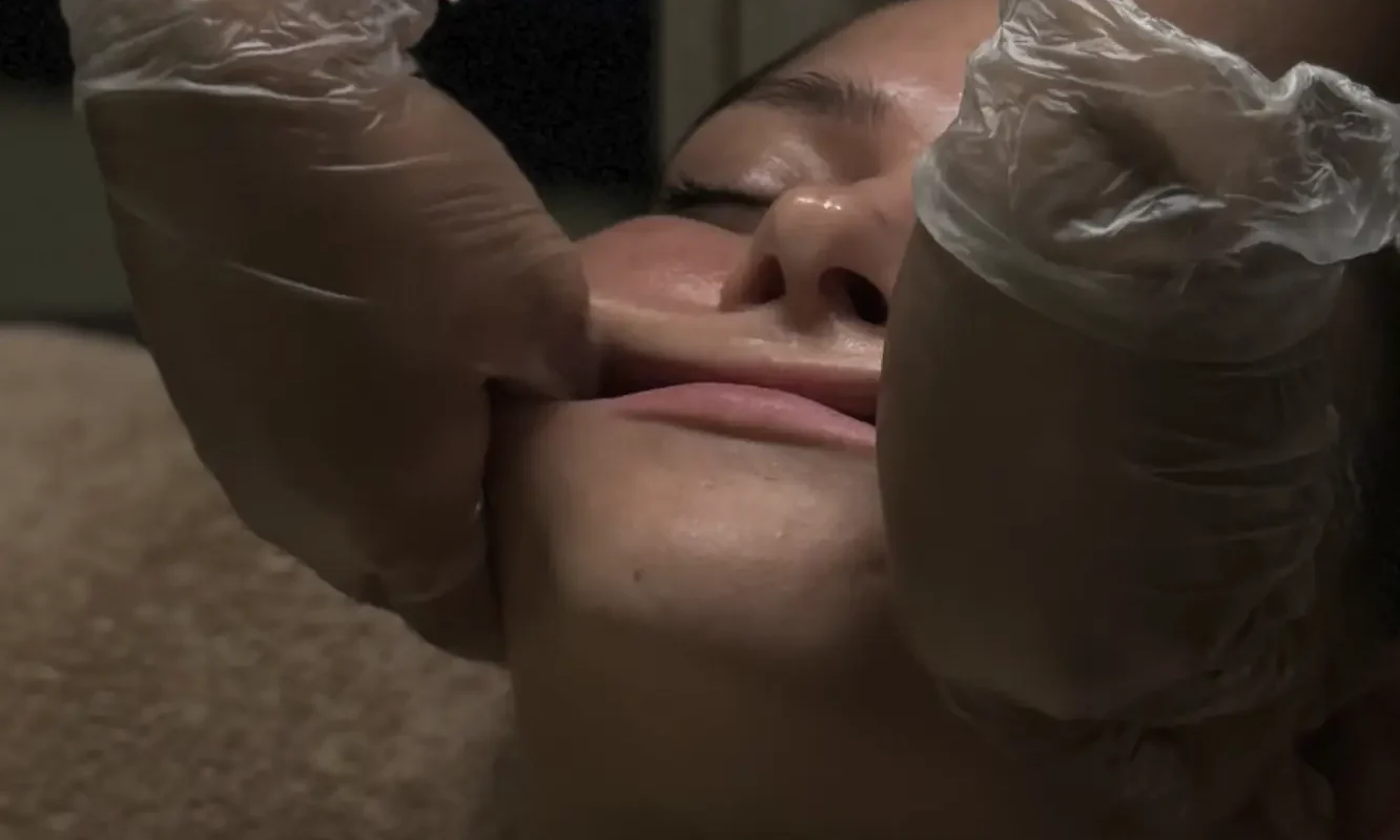 Is buccal massage a safe alternative to buccal fat removal?