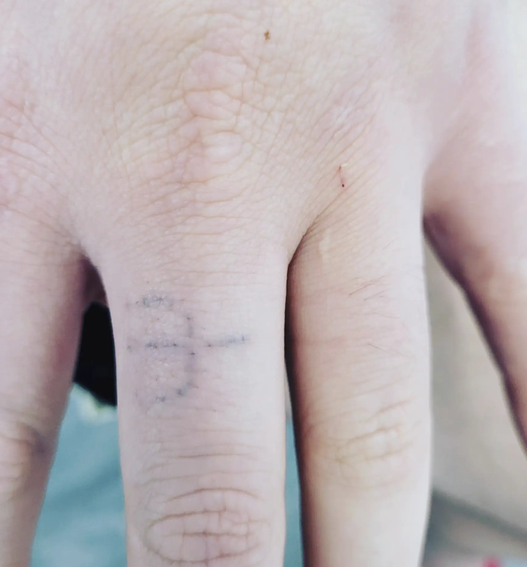 laser tattoo removal course victoria